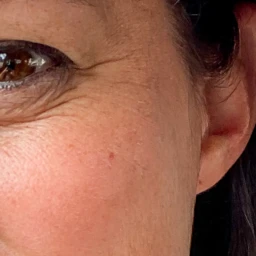 Peau du visage naturelle – texture et singularité de la peau
