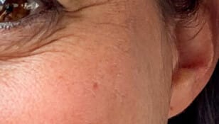 Peau du visage naturelle – texture et singularité de la peau